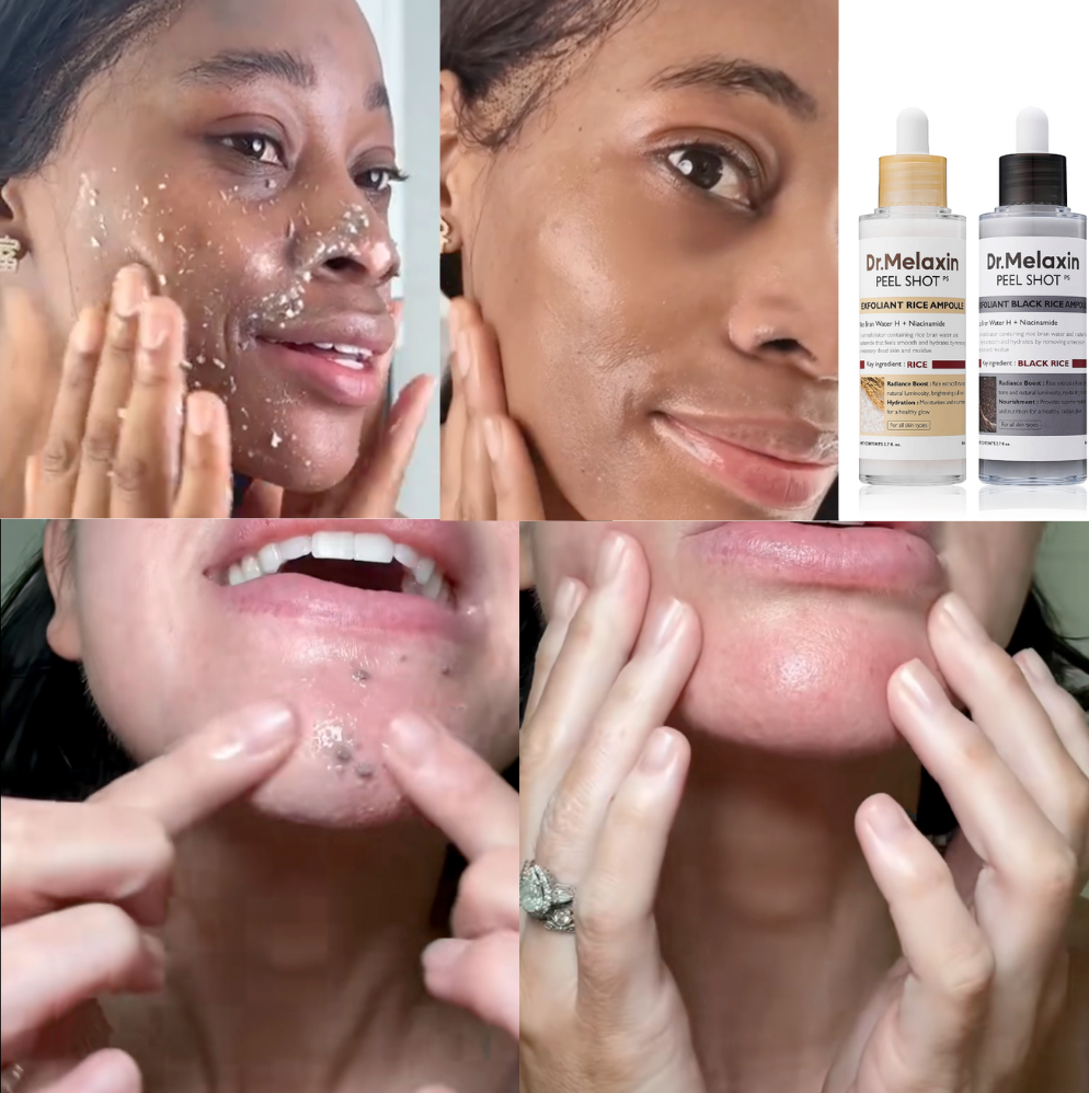 Dr Melaxins Peel Shot